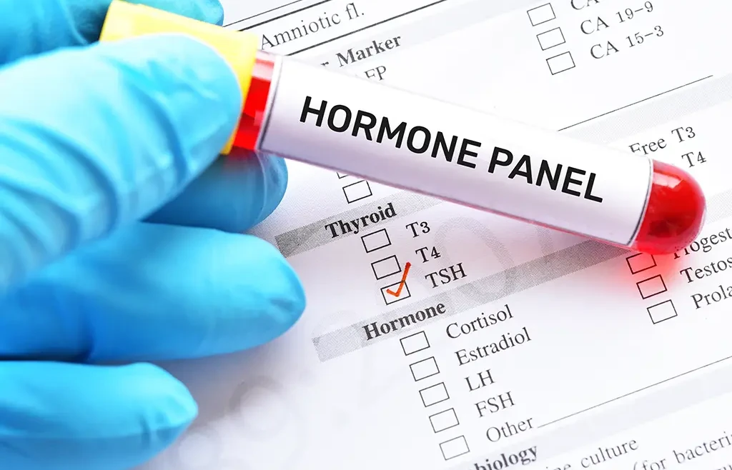 ¿Qué dice tu perfil hormonal sobre ti? Qué significan las pruebas.