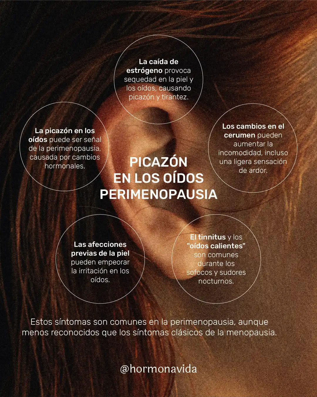 Infographic Itchy Ears Perimenopause Infografia Picazon en los oidos perimenopausia
