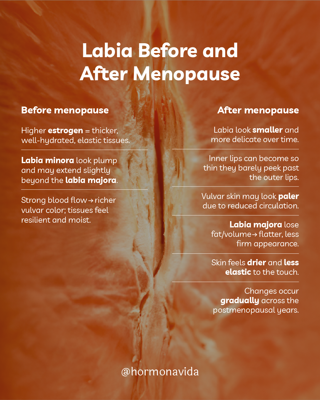 Infographic Labia before and after menopause Infographic Labia before and after menopause